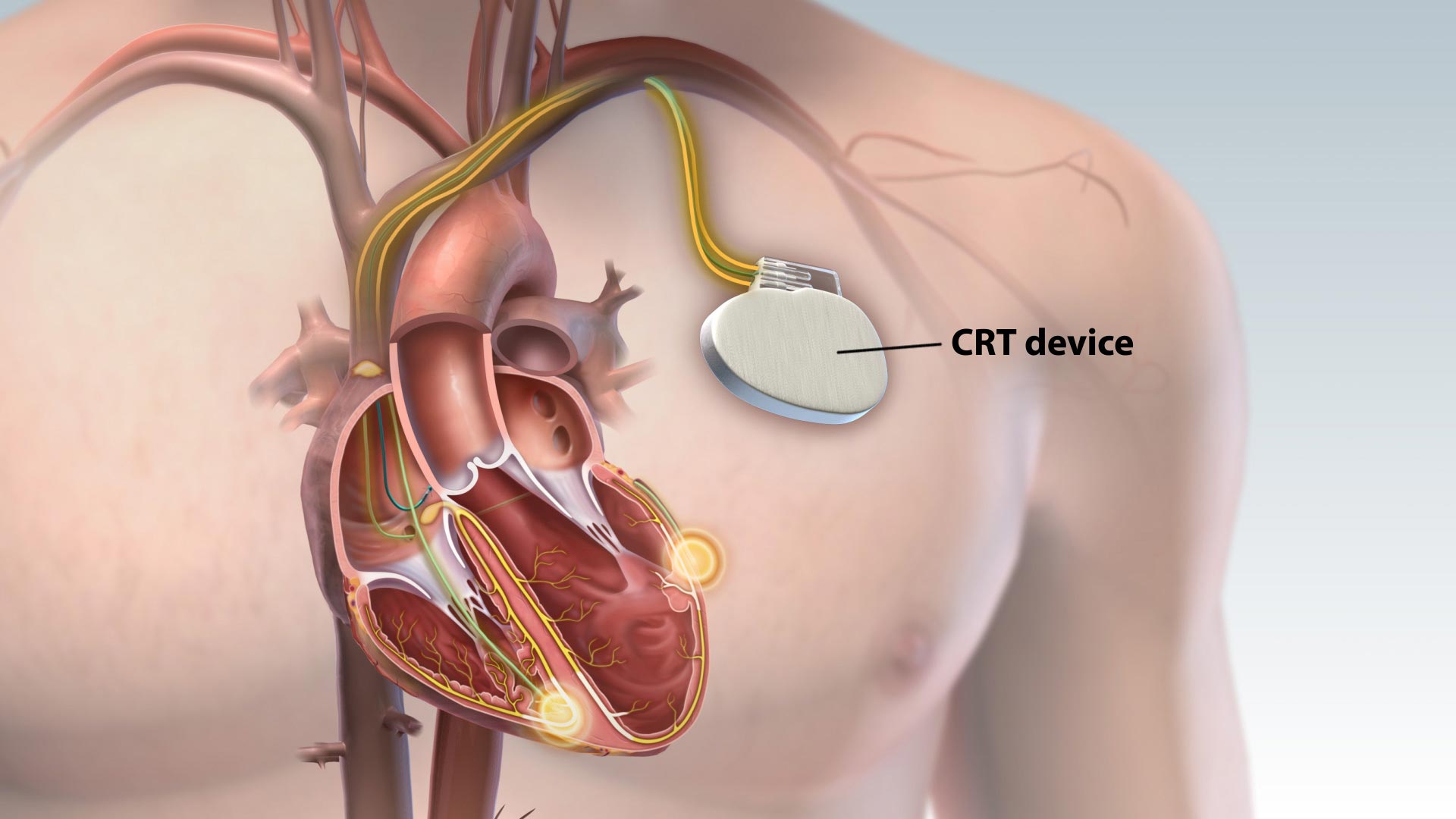 CRTDevice_1920x1080